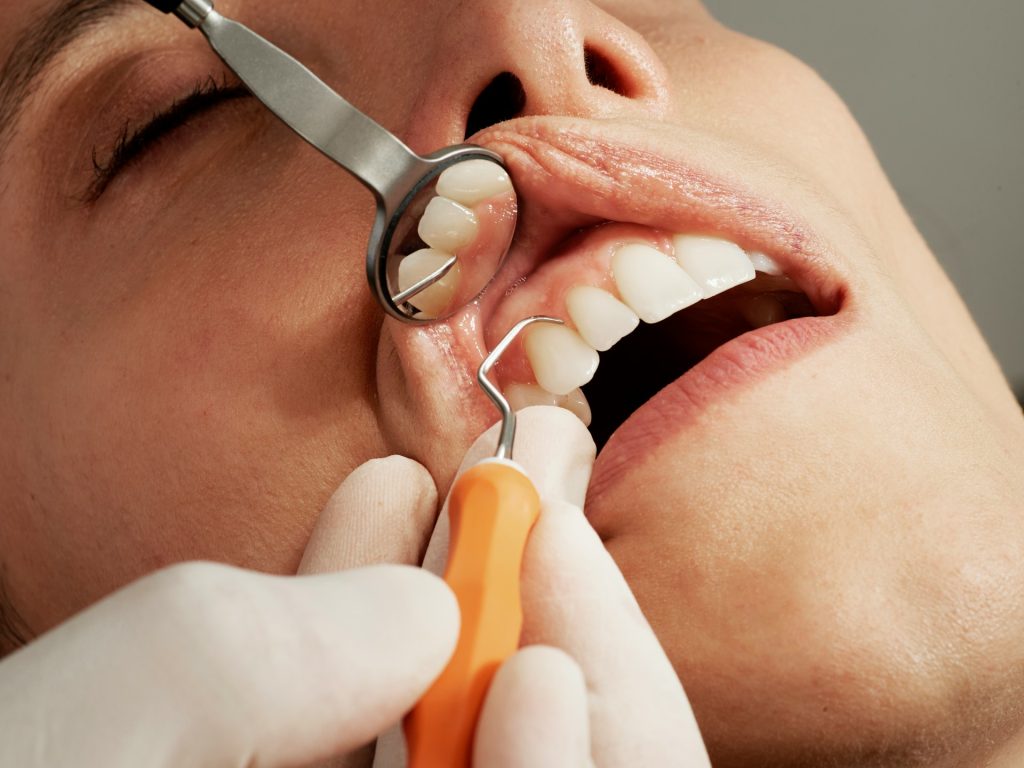 dental implant technology